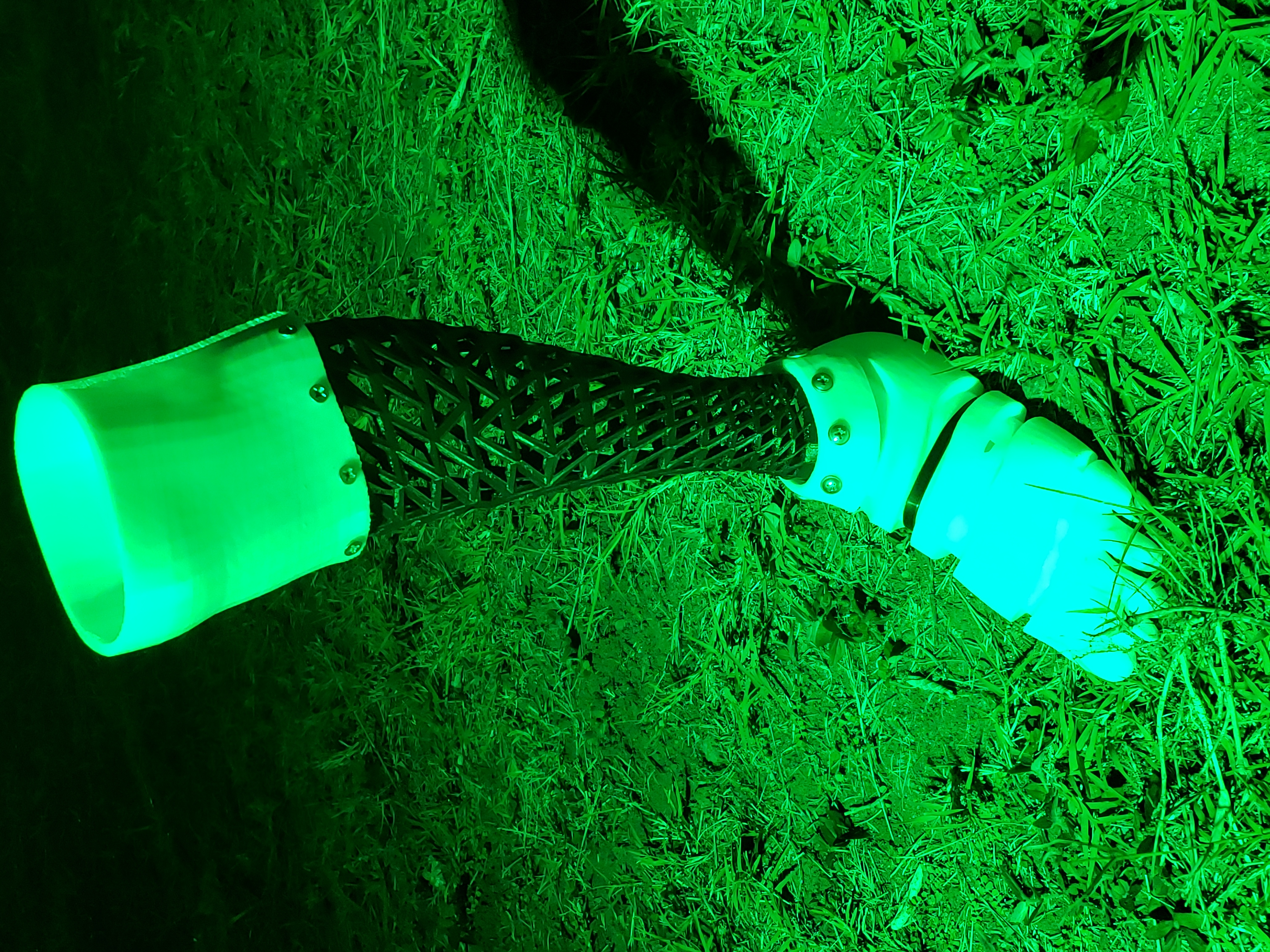 Embassy greens BioMec prosthetic for St Patrick's Day